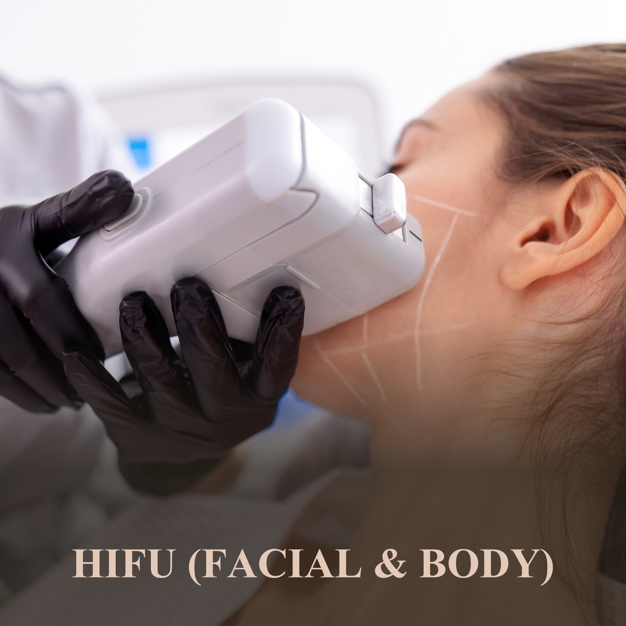 HIFU Treatments